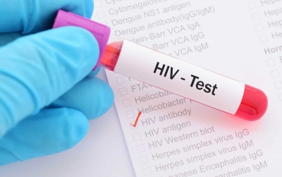 Sumut Urutan Enam Kasus HIV