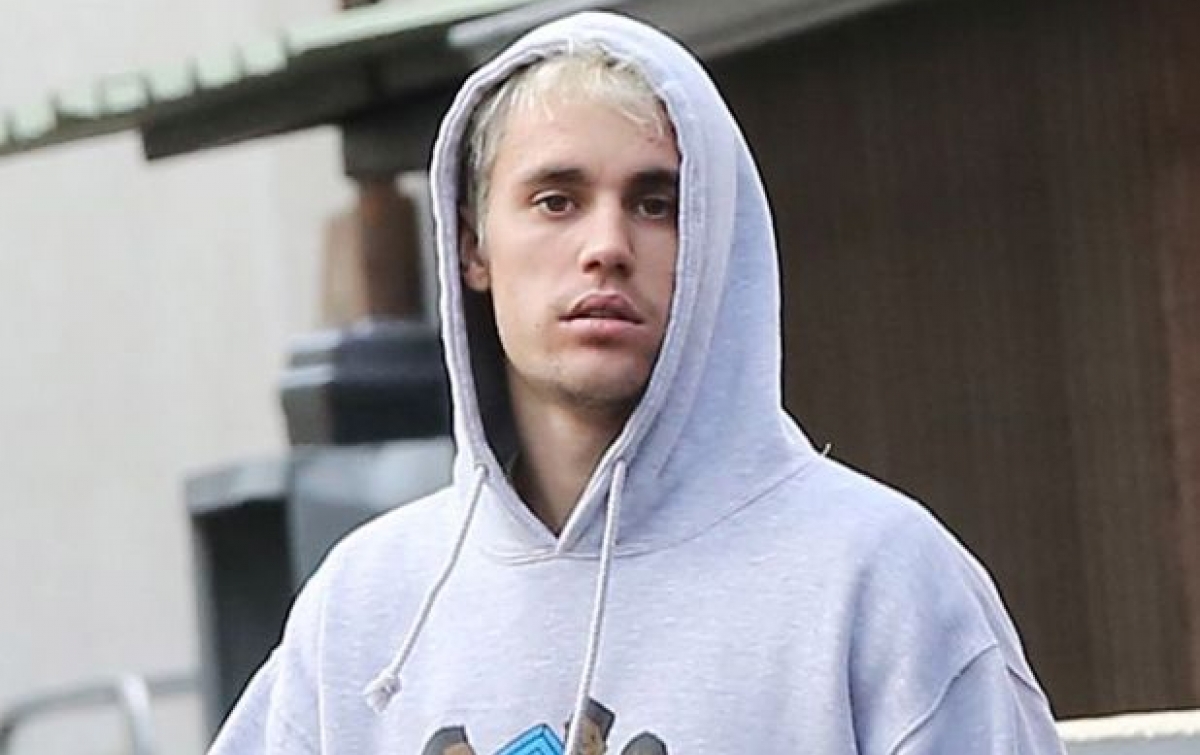 Justin Bieber Sampaikan Penyakit yang Dialami