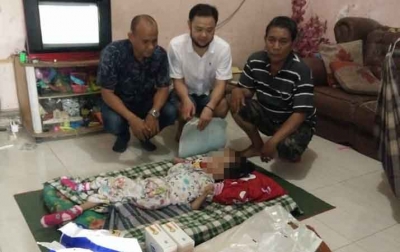 Penderita Hidrosefalus Jadi Anak Angkat Bhineka Grup