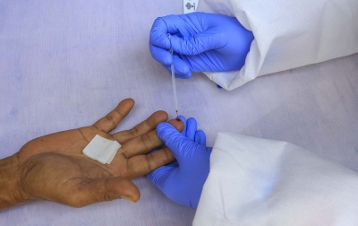 Kasus Covid-19 Global Mendekati Angka 10 Juta