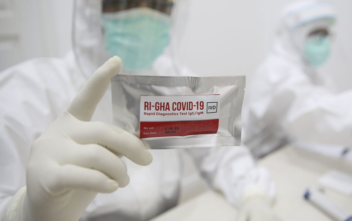 Pandemi Covid-19 Berdampak Pada Pengobatan Penderita ODHA