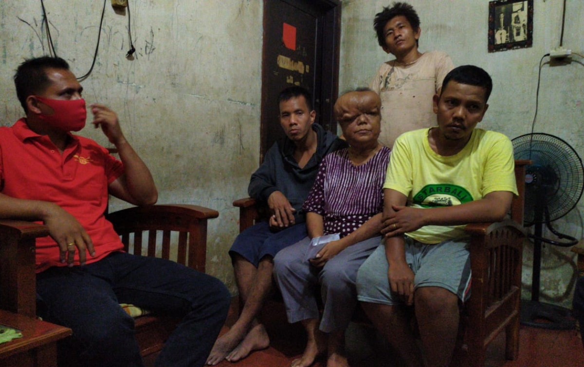 Angkatan Muda Sisingamagaraja XII Beri Bantuan Dana untuk Penderita Kanker