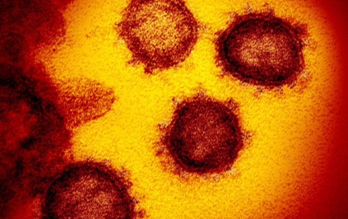 Virus Covid-19 Bisa Bertahan Selama 28 Hari