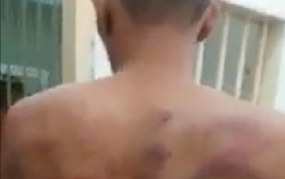 Penjelasan Kalapas Klas I Medan Mengenai Badan Napi Luka-luka