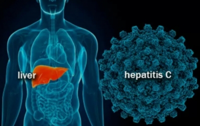 Alami Gangguan Hati Boleh Divaksin Covid-19