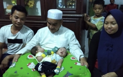 Anggota DPRD Deliserdang Rakhmadsyah Jenguk Bayi Kembar Siam