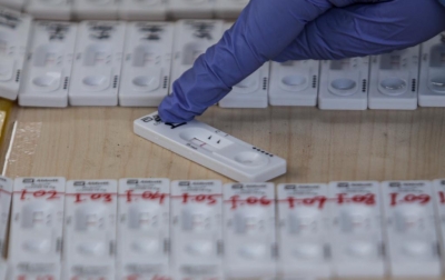 Lonjakan Covid-19 Dipengaruhi Testing dan Tracing