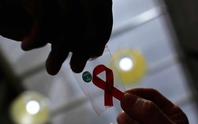 Wanita Pertama Sembuh dari HIV Pasca Transplantasi Sel