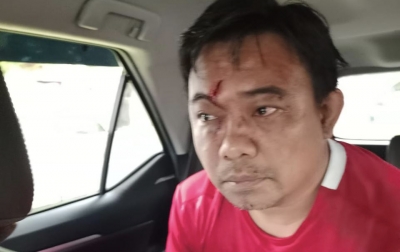 Ketua Umum KNPI Haris Pertama Diserang OTK di Rumah Makan Cikini