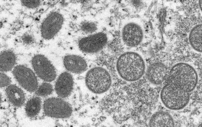 WHO Serukan Tindakan Mendesak Atasi Cacar Monyet di Eropa