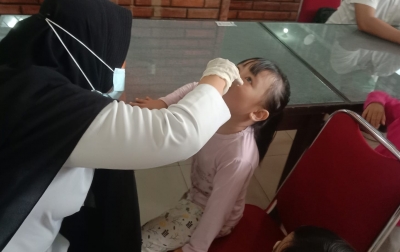 Inalum Perkuat Upaya Penanggulangan Polio Anak Usia Dini