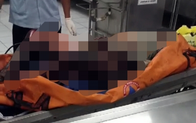 Meninggal Dunia di Bali, Keluarga Lakukan Autopsi di RS Bhayangkara Medan