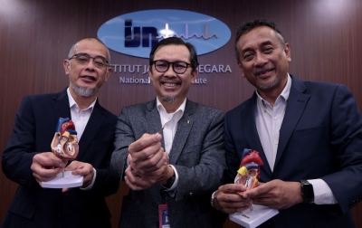 Pertama di Asia Tenggara, IJN Tanamkan Pacu Jantung Tanpa Kabel 2 Ruang