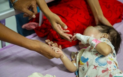 Perjuangan Mikhayla Melawan Retinoblastoma