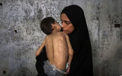 Korban Tewas Kelaparan di Gaza Capai 212 Orang, 98 Anak-anak