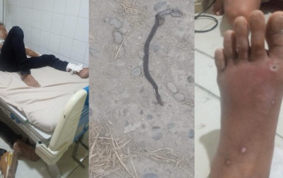 Dipatuk Kobra, 4 Jam Sempat ‘Berkeliling’ ke Berbagai RS di Medan, Sutrisno: Terima Kasih Perawat-Dokter RSUPH Adam Malik