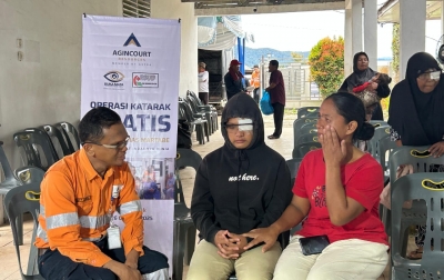 PT Agincourt Resources Teruskan Operasi Katarak Gratis, Sudah 12.896 Mata Tertangani