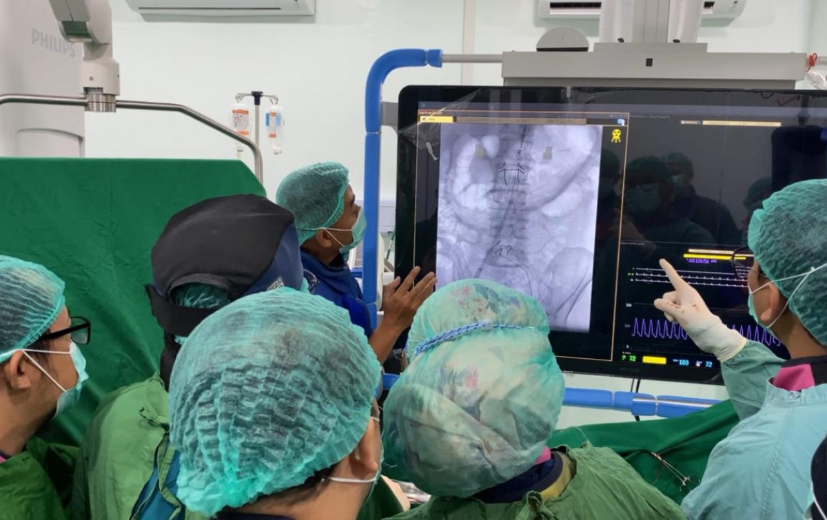 Penanganan Pembesaran Pembuluh Darah di Perut, EVAR Hadir di RS Adam Malik