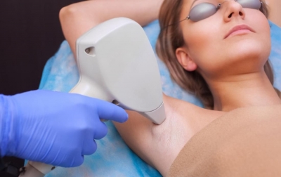 Kesalahan yang Harus Dihindari Setelah Laser Hair Removal
