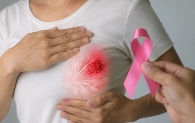 Kanker Payudara Kerap Terlambat Terdeteksi pada Perempuan