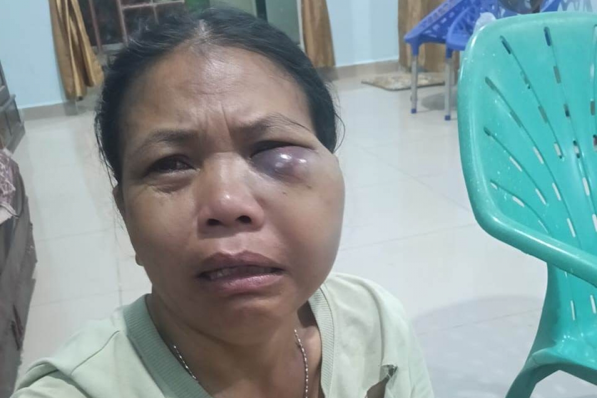 Lempar Istri Pakai Kelapa hingga Lebam, Polres Dairi Tahan Pelaku