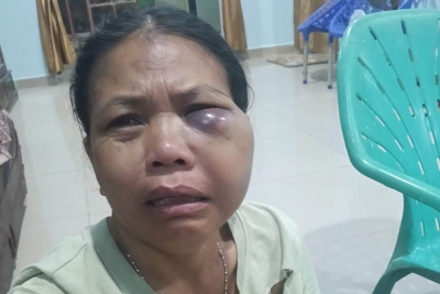 Lempar Istri Pakai Kelapa hingga Lebam, Polres Dairi Tahan Pelaku