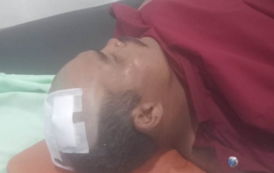 Bentrok Sengketa Lahan di Sumbul: Robert Sihotang Luka, Alat Berat Dibakar