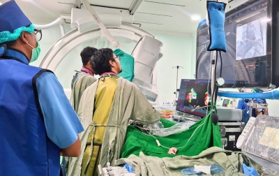 Penanganan Singkat, RS Adam Malik Tangani Aritmia dengan Teknologi PFA
