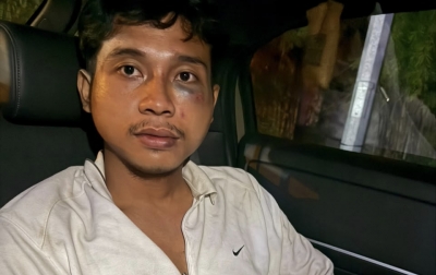 Dianiaya dan Diancam Sajam oleh Teman Mantan Pacar,   Fadlan Laporan ke Polisi